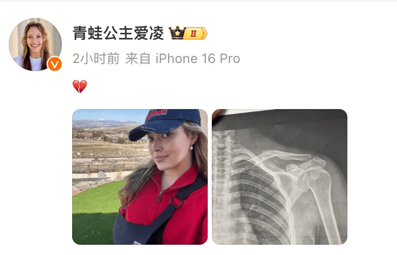 哈尔滨亚冬